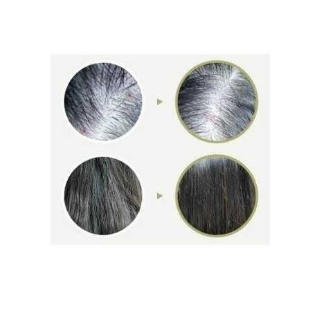 Тоник для кожи головы против выпадения волос Lador Dermatical Scalp Helper Hair Tonic